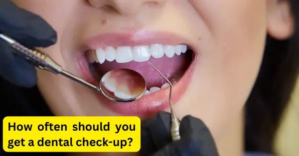 How often should you get a dental check-up
